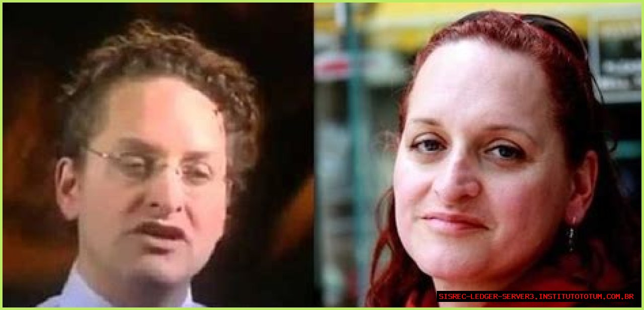 Dr. Lynette Nusbacher Before And After: A Journey Of Transformation