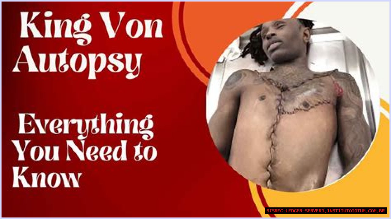 King Von Autopsy Photo: An Insight Into The Life And Legacy Of A Rising Star